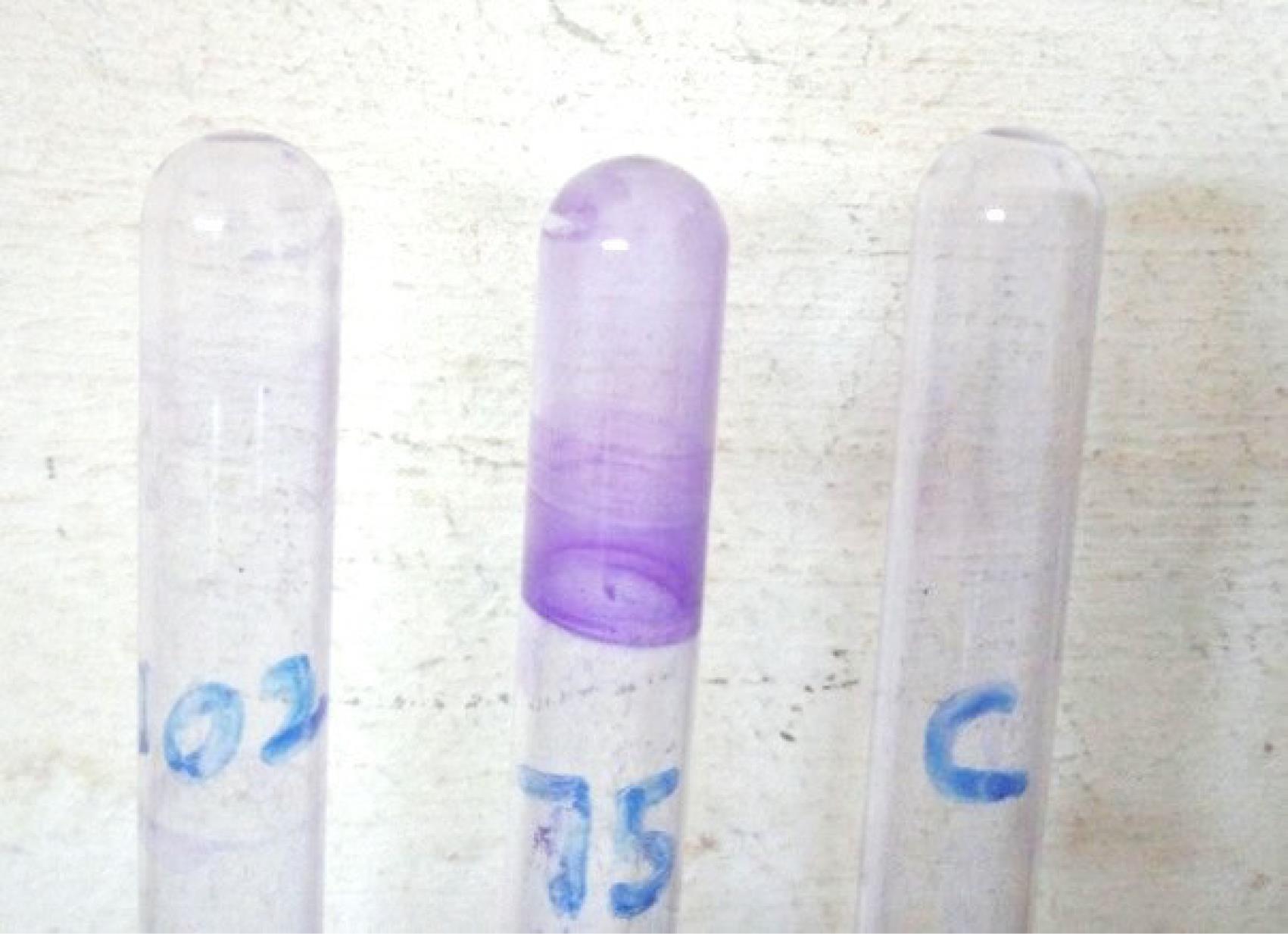 ajcmi-11-100-g001