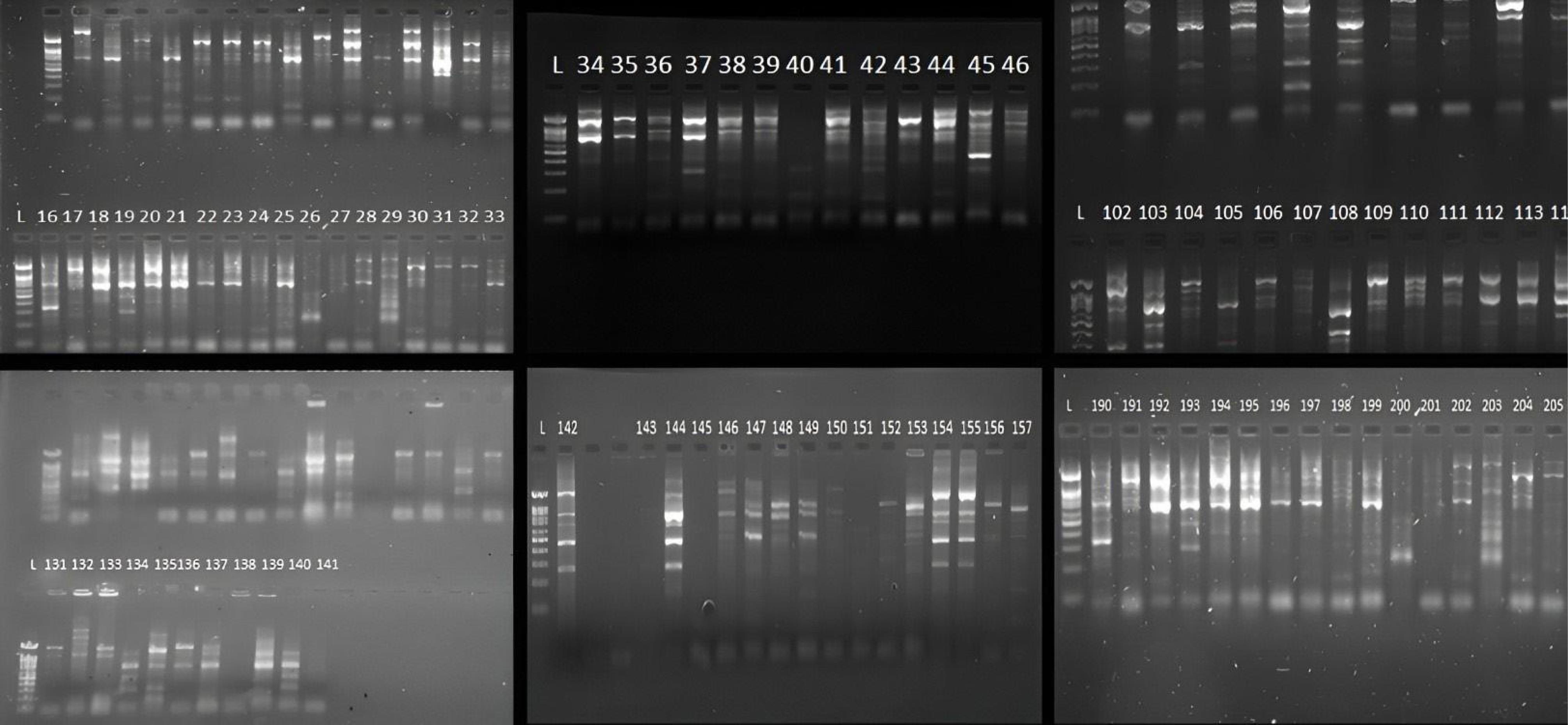 ajcmi-12-180-g005